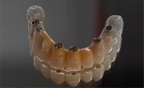 Implant Workflow