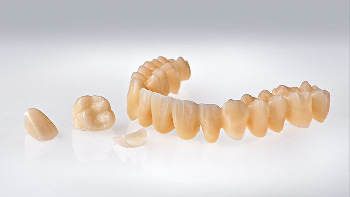 PMMA Resin Discs: The Diverse Radiance in Dental Applications