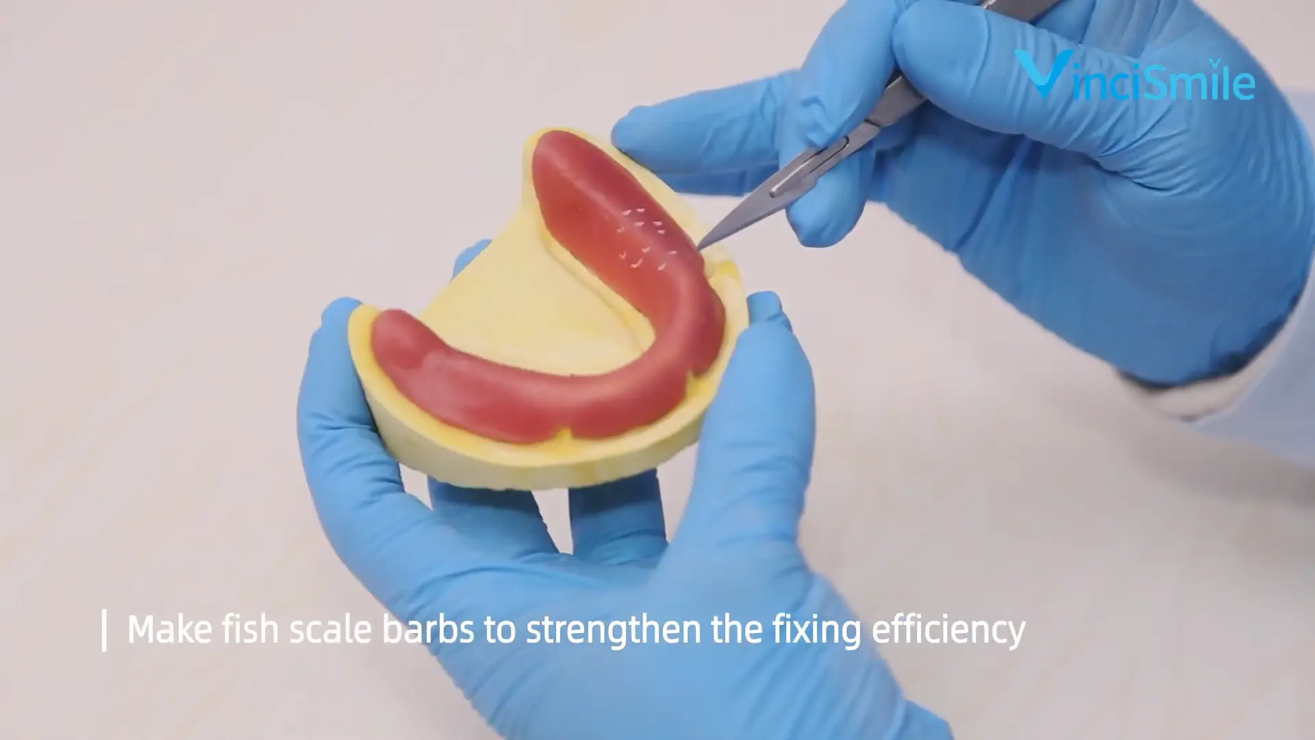 Application of Light Curing Tray in Complete Denture - Make Temperatory Base