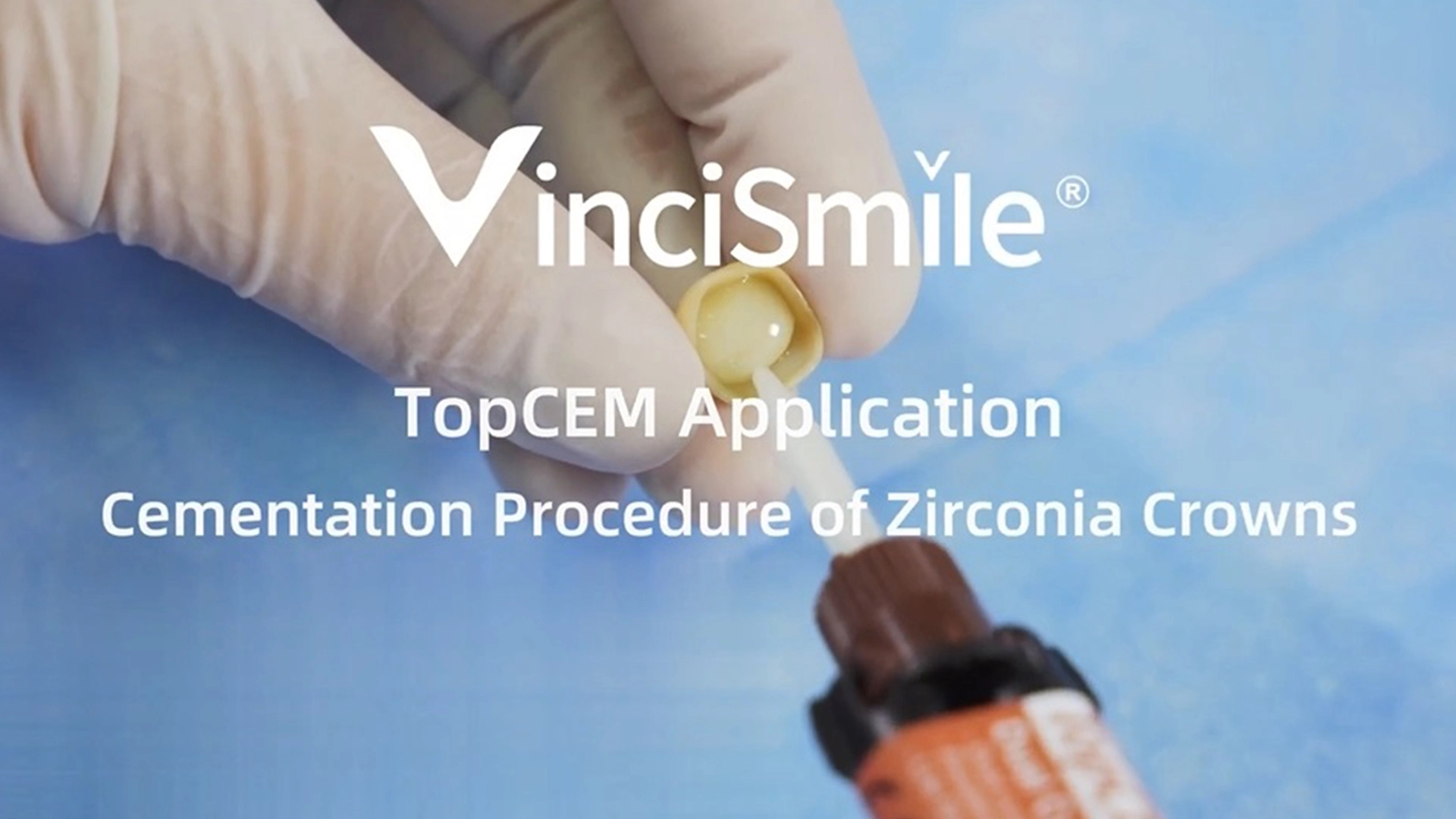 VinciSmile TopCEM Indirect Restoration - Cementation of Zirconia Crowns