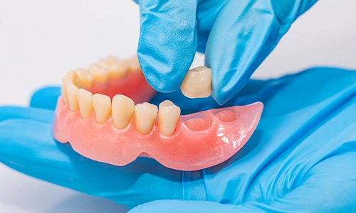 How Artificial Denture Teeth Improve Quality of Life