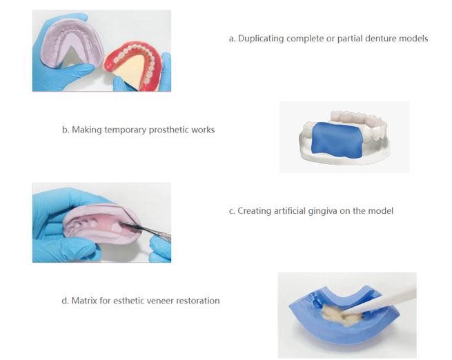 Accurate Dental Model Duplication With Alphαlab